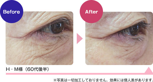 H・M様（60代後半）